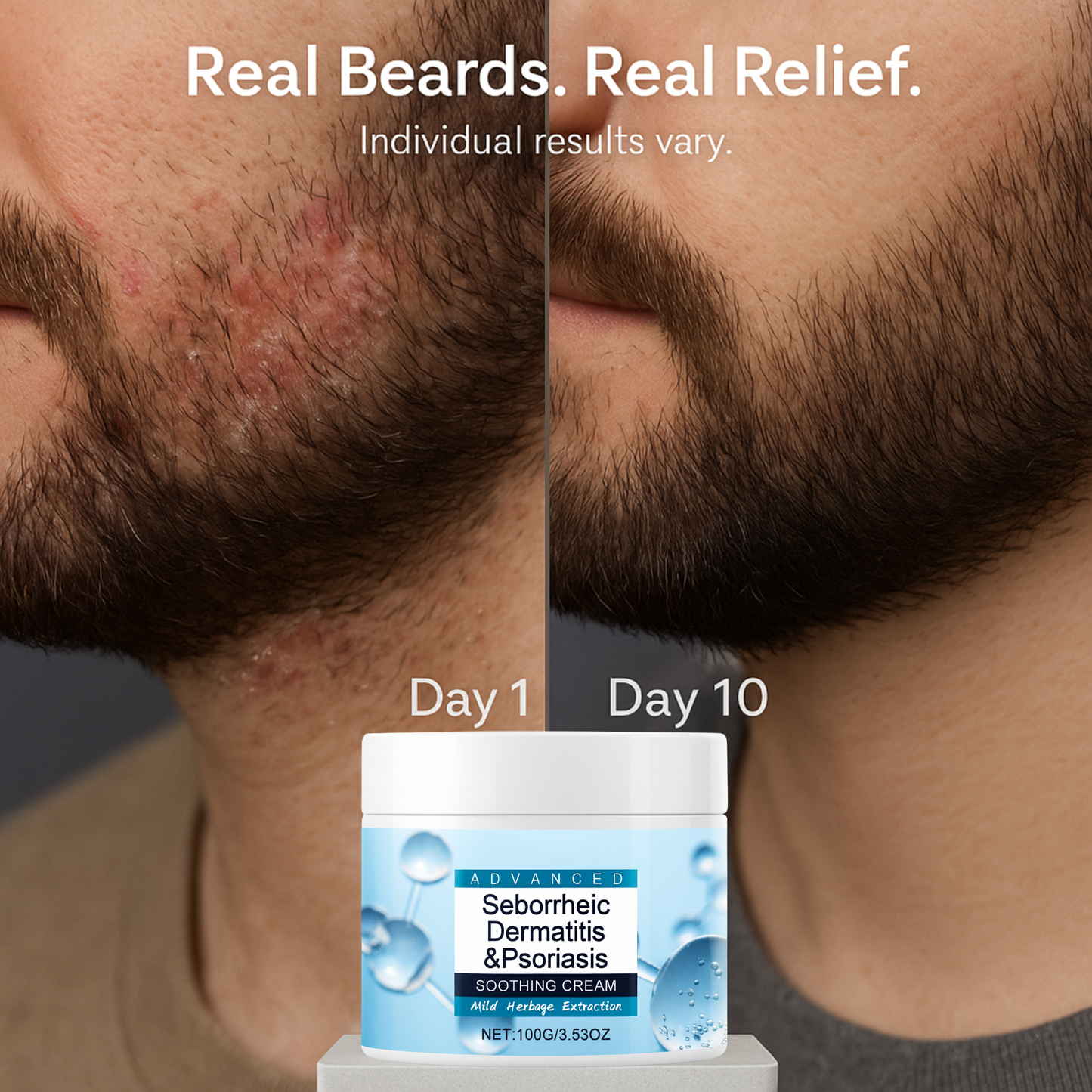 DermaCalm Beard Cream